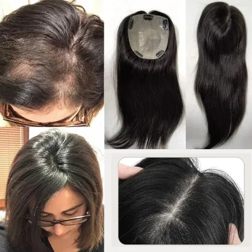 Best Hair Patch in Raipur