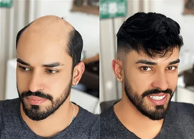 Natural Hair Wig in Raipur